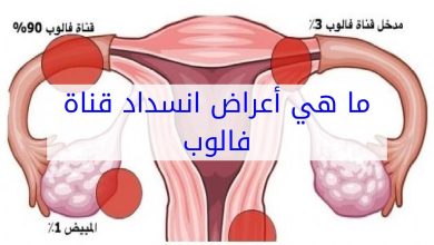 أعراض انسداد قنوات فالوب-الأسباب وإمكانية الحمل